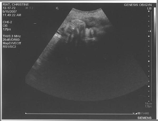 Baby Riat May 15.jpg